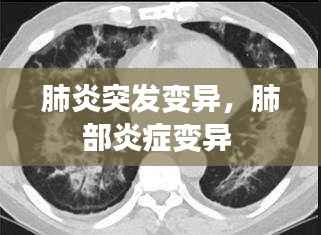 肺炎突发变异,肺部炎症变异